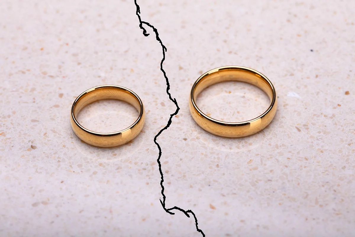 Развод кольца
